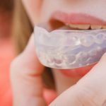 Knoxville Dental Mouth Guards