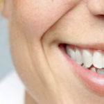 Knoxville Dental Onlays and Inlays